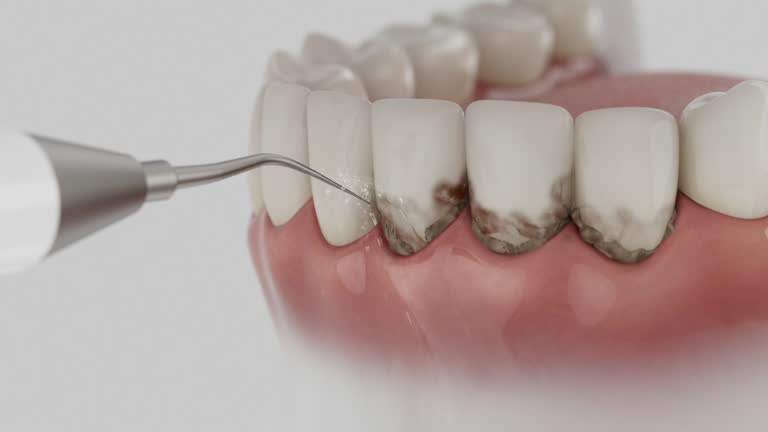 Reliable Dental contractor in Brooktrails, CA by Smile Center Dentistry